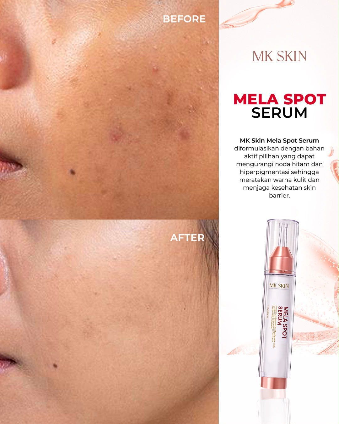 MK SKIN Mela Spot Serum - Gambar 3